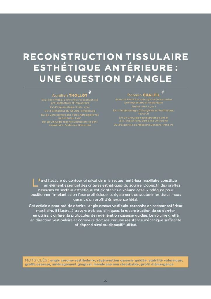 Reconstruction tissulaire esthétique antérieure : une question d'angle (Quintessence International)